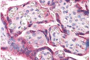 Human Placenta: Formalin-Fixed, Paraffin-Embedded (FFPE) (RYBP 抗体  (AA 71-120))
