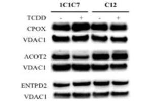 Western blot analysis of differentially expressed proteins identified by SILAC in hepatoma 1c1c7 and c12 cells exposed to DMSO or TCDD Source: PMID27105554 (ENTPD2 抗体  (AA 401-495))