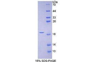 SDS-PAGE (SDS) image for Calcitonin-Related Polypeptide alpha (CALCA) (AA 1-127) protein (His tag) (ABIN2120701) (CGRP Protein (AA 1-127) (His tag))