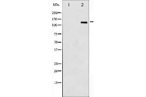 Western blot analysis of HDAC6 phosphorylation expression in NIH-3T3 whole cell lysates,The lane on the left is treated with the antigen-specific peptide. (HDAC6 抗体  (pSer22))