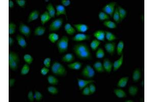 Immunofluorescence (IF) image for anti-Cytochrome P450, Family 2, Subfamily C, Polypeptide 19 (CYP2C19) (AA 245-353) antibody (ABIN7149243)