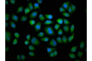 Immunofluorescence staining of Hela cells with ABIN7149243 at 1:133, counter-stained with DAPI. (CYP2C19 抗体  (AA 245-353))