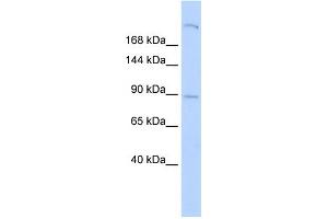 WB Suggested Anti-SHROOM2 Antibody Titration:  0. (SHROOM2 抗体  (Middle Region))