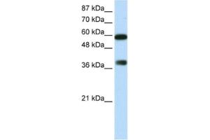 Western Blotting (WB) image for anti-AT Rich Interactive Domain 3B (BRIGHT-Like) (ARID3B) antibody (ABIN2461791) (ARID3B 抗体)