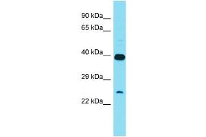 Host: Rabbit Target Name: XRCC6BP1 Sample Type: HT1080 Whole Cell lysates Antibody Dilution: 1. (XRCC6BP1 抗体  (C-Term))