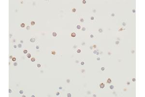 Immunocytochemistry (ICC) image for anti-Mitogen-Activated Protein Kinase Kinase 2 (MAP2K2) (AA 1-50) antibody (ABIN7454013) (Recombinant MEK2 抗体  (AA 1-50))