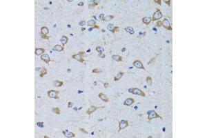 Immunohistochemistry of paraffin-embedded rat brain using RARS antibody (ABIN6127449, ABIN6146708, ABIN6146709 and ABIN6221913) at dilution of 1:100 (40x lens). (RARS 抗体  (AA 1-300))
