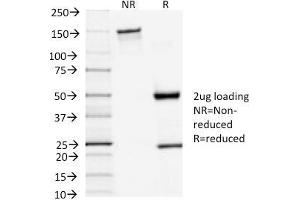 SDS-PAGE Analysis Purified TSH-Receptor, A-Chain Mouse Monoclonal Antibody (TSHRA/1402). (TSH receptor 抗体)