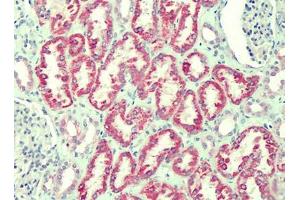 Human Kidney: Formalin-Fixed, Paraffin-Embedded (FFPE) (ANTXR2 抗体)