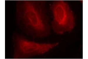 Image no. 3 for anti-3-phosphoinositide Dependent Protein Kinase-1 (PDPK1) (pSer241) antibody (ABIN196617) (PDPK1 抗体  (pSer241))
