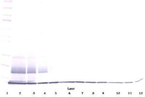Western Blotting (WB) image for anti-Chemokine (C-C Motif) Ligand 27 (CCL27) antibody (ABIN783046)