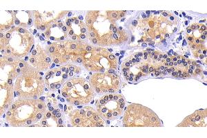 Detection of MMP7 in Human Kidney Tissue using Polyclonal Antibody to Matrix Metalloproteinase 7 (MMP7) (MMP7 抗体  (AA 1-267))