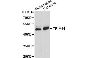 Western blot analysis of extracts of various cells, using TRIM44 antibody. (TRIM44 抗体)