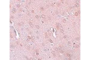 Immunohistochemistry (IHC) image for anti-Potassium Channel Subfamily K Member 18 (KCNK18) (Middle Region) antibody (ABIN1031143) (KCNK18 抗体  (Middle Region))