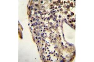 Immunohistochemistry (Paraffin-embedded Sections) (IHC (p)) image for anti-KH Domain Containing 3-Like, Subcortical Maternal Complex Member (KHDC3L) (AA 27-56), (N-Term) antibody (ABIN952017)
