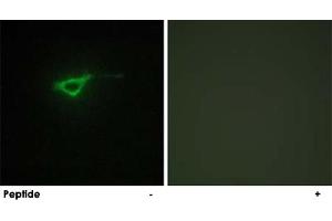 Immunofluorescence analysis of NIH/3T3 cells, using COL20A1 polyclonal antibody . (COL20A1 抗体  (C-Term))
