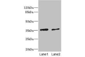 Western blot All lanes: EFNB3 antibody at 1. (Ephrin B3 抗体  (AA 28-226))