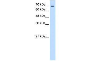 WB Suggested Anti-TGM2 Antibody Titration:  0. (Transglutaminase 2 抗体  (N-Term))