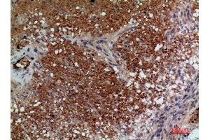 Immunohistochemistry (IHC) image for anti-Rh Family A Glycoprotein (RHAG) (N-Term) antibody (ABIN3181013)