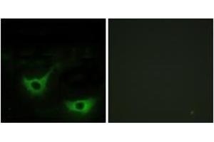 Immunofluorescence analysis of NIH-3T3 cells, using CALR Antibody. (Calreticulin 抗体  (AA 21-70))