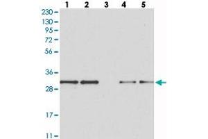 Western blot analysis of Lane 1: RT-4, Lane 2: U-251 MG, Lane 3: Human Plasma, Lane 4: Liver, Lane 5: Tonsil with MAPK1IP1L polyclonal antibody  at 1:250-1:500 dilution. (MAPK1IP1L 抗体)