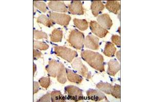 ARL17P1 Antibody immunohistochemistry analysis in formalin fixed and paraffin embedded human skeletal muscle followed by peroxidase conjugation of the secondary antibody and DAB staining. (ARL17A 抗体  (AA 102-130))