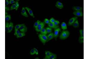 Immunofluorescence staining of HepG2 cells with ABIN7144312 at 1:100, counter-stained with DAPI. (Anoctamin 6 抗体  (AA 12-100))