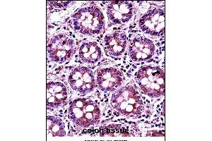 RANG Antibody (N-term) 3776a immunohistochemistry analysis in formalin fixed and paraffin embedded human colon tissue followed by peroxidase conjugation of the secondary antibody and DAB staining. (RANGAP1 抗体  (N-Term))