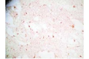 Human brain tissue was stained by Rabbit Anti-Synaptotagminm IV(73-97) (Human) Antibody (SYT4 抗体  (AA 73-97))
