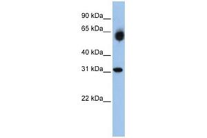 WB Suggested Anti-DHRS2  Antibody Titration: 0. (DHRS2 抗体  (Middle Region))