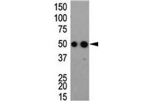 Western blot analysis of HA antibody and tagged recombinant protein bacterial lysate (HA-Tag 抗体)