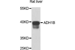Western blot analysis of extracts of rat liver cells, using ADH1B antibody. (ADH1B 抗体)