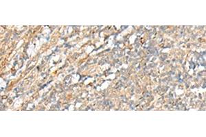 Immunohistochemistry (Paraffin-embedded Sections) (IHC (p)) image for anti-Proprotein Convertase Subtilisin/kexin Type 5 (PCSK5) antibody (ABIN7004184)