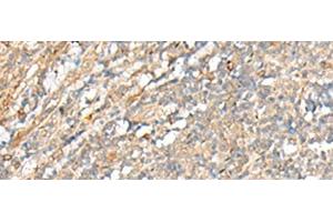 Immunohistochemistry of paraffin-embedded Human tonsil tissue using PCSK5 Polyclonal Antibody at dilution of 1:35(x200) (PCSK5 抗体)
