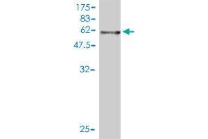 Western Blot detection against Immunogen (57. (APP 抗体  (AA 19-305))