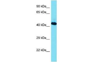Host: Rabbit Target Name: RBMX Sample Type: Jurkat Whole Cell lysates Antibody Dilution: 1. (RBMX 抗体  (C-Term))