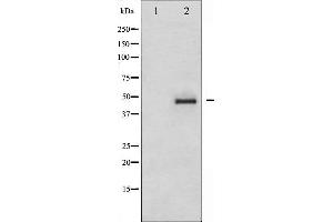 Western blot analysis of CrkII expression in COS7 whole cell lysates,The lane on the left is treated with the antigen-specific peptide. (Crk 抗体)