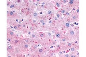 Anti-GCGR / Glucagon Receptor antibody IHC of human liver. (Glucagon Receptor 抗体  (N-Term))