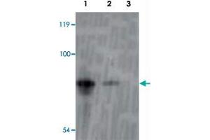 Western blot analysis of recombinant inaD protein using inaD polyclonal antibody  at 1:1000 dilution. (Inactivation No Afterpotential D (INAD) (AA 659-674) 抗体)