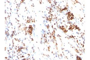 Immunohistochemistry (IHC) image for anti-Cyclin-Dependent Kinase Inhibitor 1B (p27, Kip1) (CDKN1B) antibody (ABIN6939047)