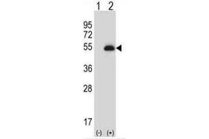 Western blot analysis of PAX6 (arrow) using rabbit polyclonal PAX6 Antibody . (PAX6 抗体)