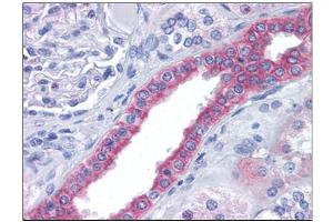 Human Kidney: Formalin-Fixed, Paraffin-Embedded (FFPE) (FAM33A 抗体  (N-Term))