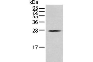 Western blot analysis of K562 cell using MOB1B Polyclonal Antibody at dilution of 1:250 (MOBKL1A 抗体)