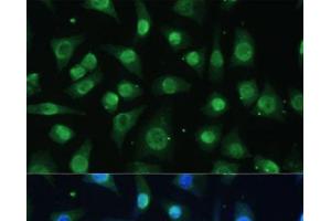 Immunofluorescence analysis of L-929 cells using HNRNPA0 Polyclonal Antibody at dilution of 1:100 (40x lens). (HNRNPA0 抗体)