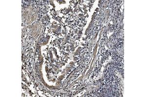 IHC analysis of REA/PHB2 using anti-REA/PHB2 antibody (ABIN7599239). (Prohibitin 2 抗体  (AA 1-299))