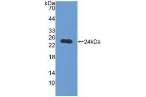 Detection of Recombinant GAMT, Human using Polyclonal Antibody to Guanidinoacetate-N-Methyltransferase (GAMT) (GAMT 抗体  (AA 64-236))