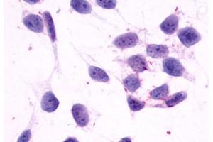 Image no. 2 for anti-Histamine Receptor H4 (HRH4) (C-Term) antibody (ABIN1048965) (HRH4 抗体  (C-Term))