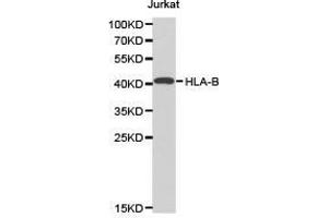 Western Blotting (WB) image for anti-Major Histocompatibility Complex, Class I, B (HLA-B) antibody (ABIN1873025) (HLA-B 抗体)