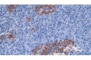 Immunohistochemistry (IHC) image for anti-Defensin, alpha 3, Neutrophil-Specific (DEFa3) (AA 21-94) antibody (ABIN7439243)
