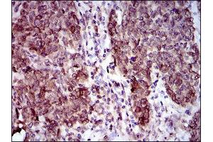 Immunohistochemistry (IHC) image for anti-Calmegin (CLGN) (AA 249-405) antibody (ABIN1843003) (Calmegin 抗体  (AA 249-405))